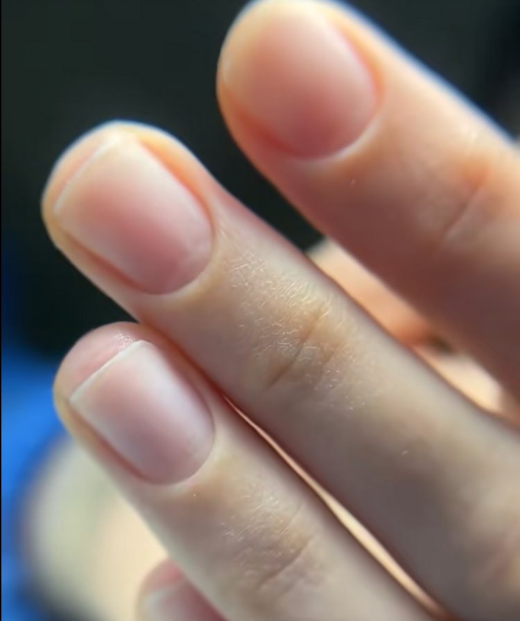 Client result